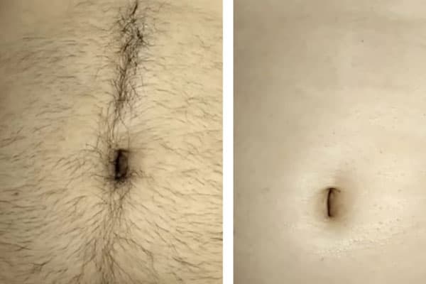 Other Waxing - Parul Beauty Salon