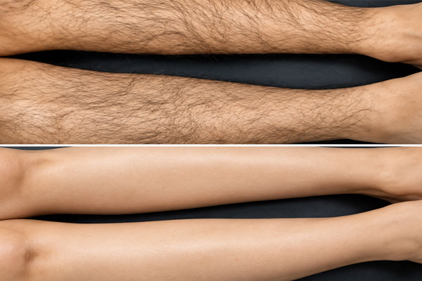Professional gentle waxing service for legs and arms